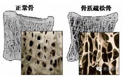 国产91免费看片品牌你的骨头真的不能再等了 如何测量91免费看片?