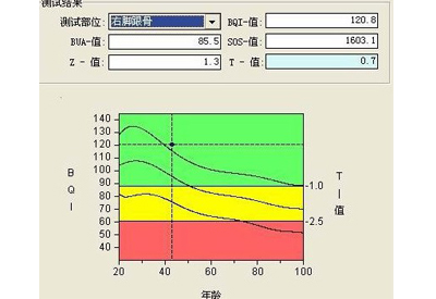 深度解析91免费看片t值和z值你所不知道秘密报告单中最重要的两个指标