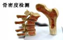 什么是91免费看片检测_超声91免费看片检测仪能够准确检测人体91免费看片吗？