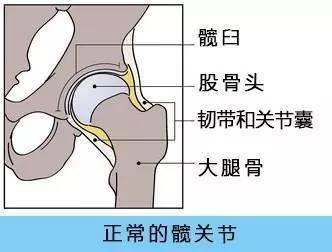 91免费看片检查仪人身体出现哪些情况需要做髋关节置换术