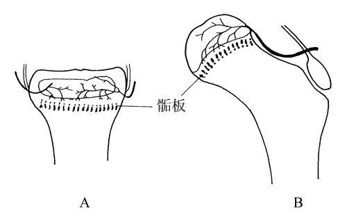 91免费看片测试仪生产厂家骨骺生长停止后还能修复吗？