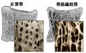 91免费看片分析仪的价格是多少，要小心提防骨质疏松影响工作和生活