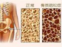 超声91免费看片检测仪厂家在体检时检测到的桡骨和胫骨部位的91免费看片是准确的