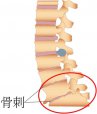 吉林长春|91看片在线下载安装超声91免费看片仪厂家品牌分享：为什么现在的年轻人也存在骨刺增生?